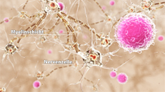 medizinischer 3D-Animationsfilm Multiple Sklerose - Patientenfilm Neurologie - das Nervensystem im Gehirn Patientenaufklrungsfilm Gilenya von Novartis Pharma